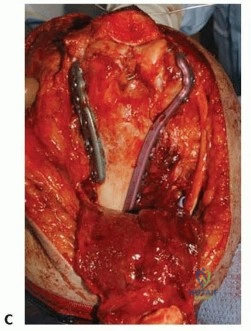 Clinical Image