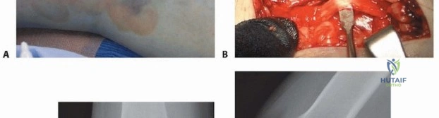 Clinical Image