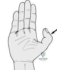 Clinical Image