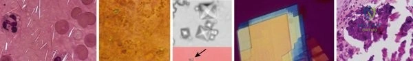 Clinical Image