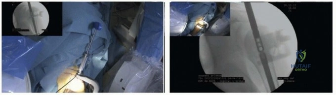 Clinical Image