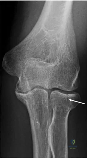 Clinical Image