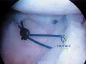 Clinical Image