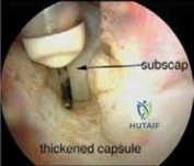Clinical Image