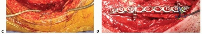 Clinical Image