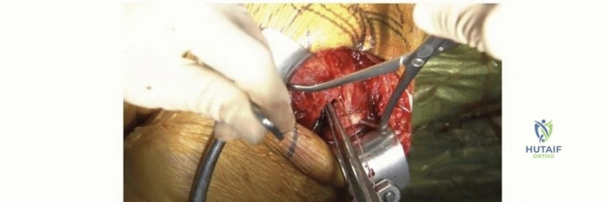 Clinical Image