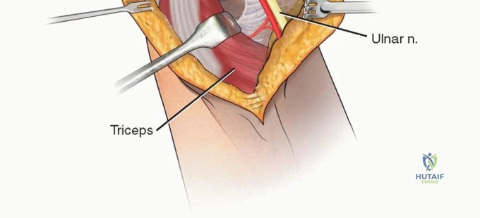 Clinical Image