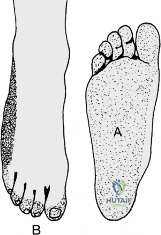 Clinical Image