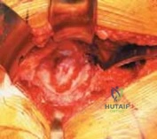 Clinical Image