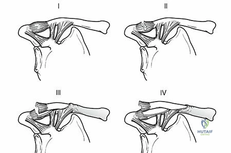 Clinical Image