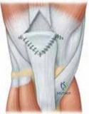 Clinical Image