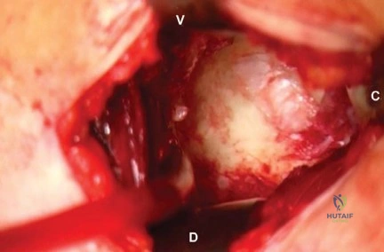 Clinical Image