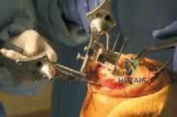 Clinical Image