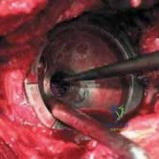 Clinical Image