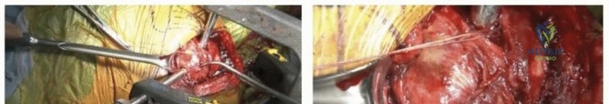 Clinical Image