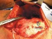 Clinical Image
