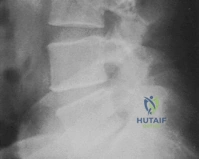 Clinical Image