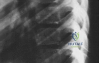Clinical Image