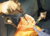 Clinical Image