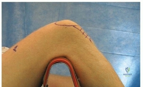 Clinical Image