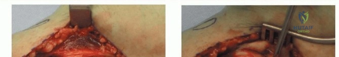 Clinical Image