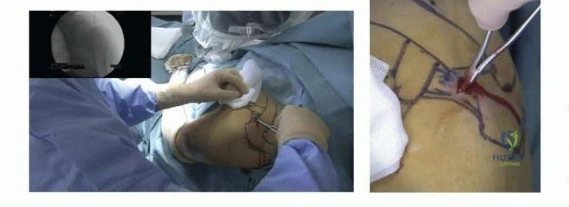 Clinical Image