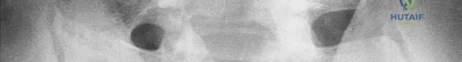 Clinical Image