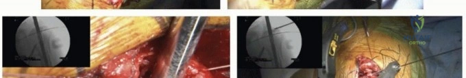 Clinical Image