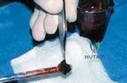 Clinical Image
