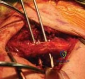 Clinical Image