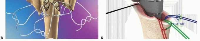 Clinical Image