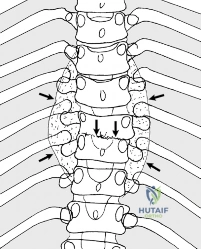Clinical Image