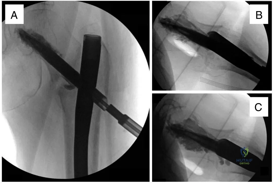 Clinical Image