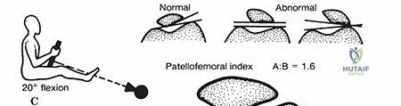 Clinical Image
