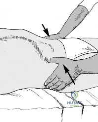 Clinical Image