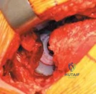 Clinical Image