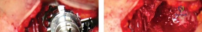 Clinical Image