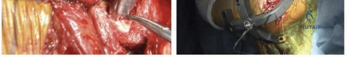 Clinical Image