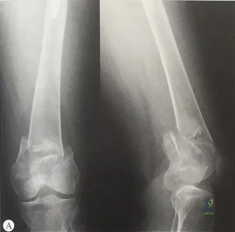 Clinical Image