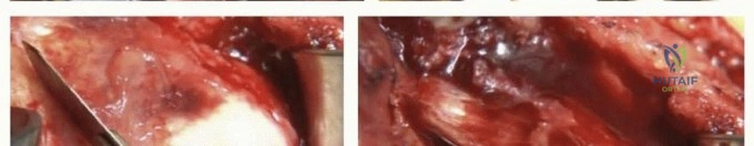 Clinical Image