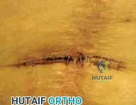 Clinical Image