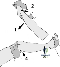Clinical Image