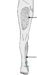 Clinical Image