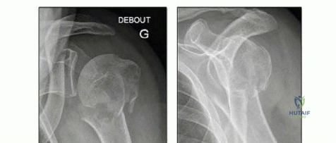 Clinical Image