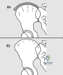 Clinical Image