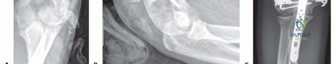 Clinical Image