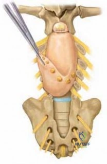 Clinical Image