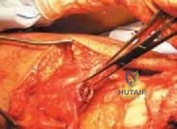 Clinical Image