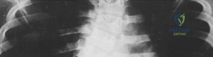 Clinical Image