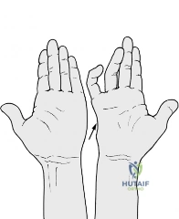 Clinical Image